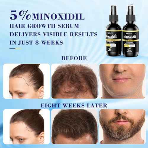 5% Minoxidil for Women with Biotin and Rosemary Hair Growth Serum (Glass Bottle), 5% Minoxidil for Men Spray for Thicker Fuller Hair