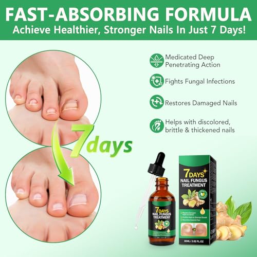 Ginger Nail Growth Strengthener Serum ? Ginger-Infused Nail Repair Oil for Care, Natural Nail and Strengthener Solution