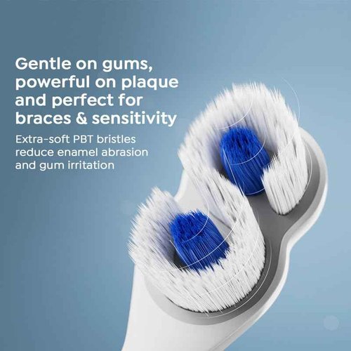 SuperMouth® ULTIM8 SmartBrush™ Electric Toothbrush - Patented SuperBristles® Clean Teeth 40X Better, Dual Sonic Modes, Pressure Sensor, Stunning Design - Teens & Adults - Pearly White