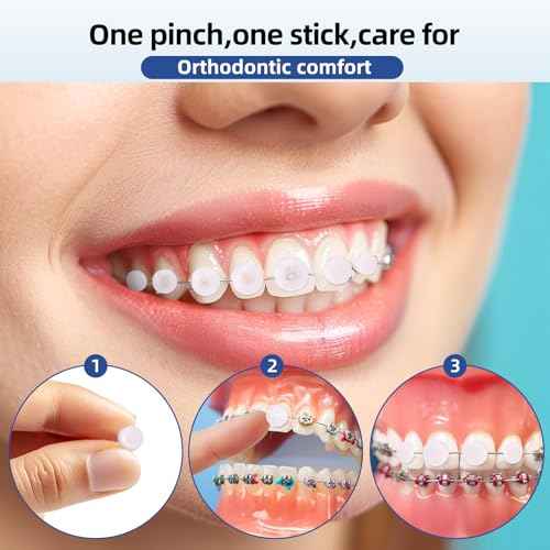 RAZOKO Orthodontic Wax for Braces Wax Dots 120 Individual Hygienic Packaging Dental Wax