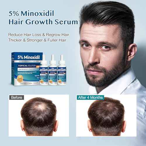 5% Minoxidil Hair Growth for Men and Women: Extra Strength Beard Regrowth Treatment Serum with Minoxidil and Biotin for Thinning Hair Loss to Grow Thicker Fuller 60ml 3 Bottles