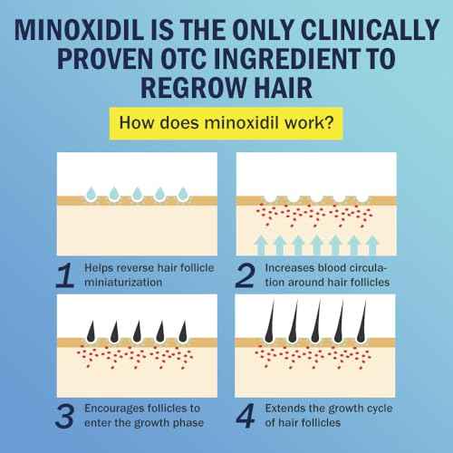 5% Minoxidil Foam for Hair Regrowth, Topical Hair Loss Treatment for Men to Regrow Fuller, Thicker Hair, Rosemary Minoxidil Topical Aerosol, 60ml / 2.11oz