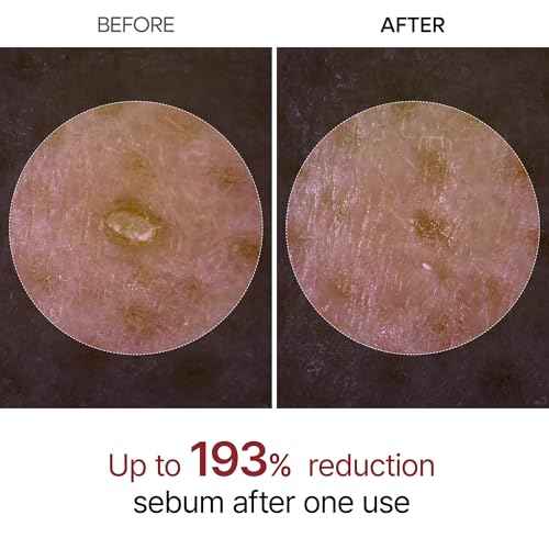 Dr.Melaxin Peel Shot Glow White Rice Peeling Ampoule, Soft Exfoliating Face and Body Scrub Dead Skin Cells Remover for All Skin Types korean skin care 80ml