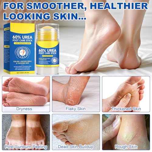 60% Urea Foot Cream Stick with 2% Salicylic Acid, Urea Foot Care Stick & Cream - Moisturizer for Dry, Cracked Skin on Feet, Knees, Elbows & Hands - Hydrates & Repairs Rough Skin 1Pack