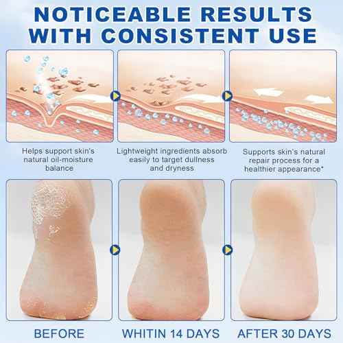 60% Urea with 2% Salicylic Acid Urea Foot Care Stick, Heel Stick for Cracked Feet, Foot Care Cream Moisturizer for Dry Cracked Feet, Knees, Elbows, Hands, Foot Lotion Stick -1.41oz