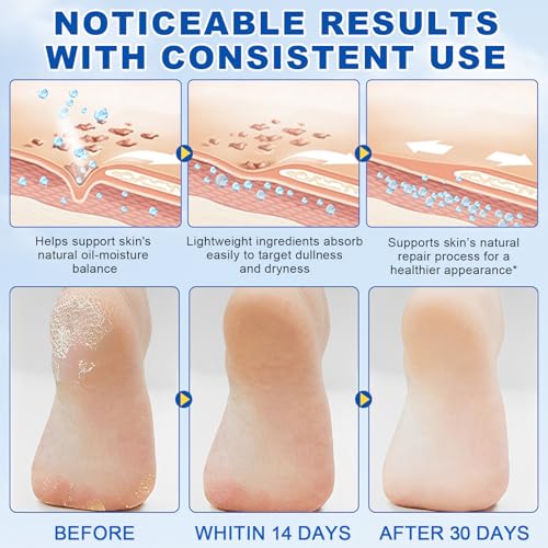 60% Urea with 2% Salicylic Acid Urea Foot Care Stick, Foot Cream Moisturizer for Dry Cracked Feet, Knees, Elbows, Hands,Moisturizes and Hydrates the Dry Skin,Callus Remover & Skin Softener -1.41oz