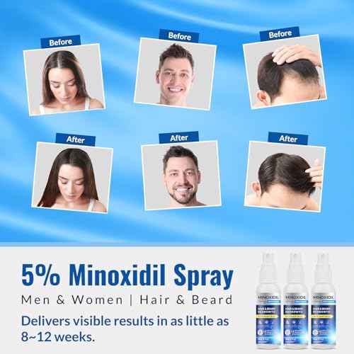 5% Minoxidil Spray 3PCS, Minoxidil for Men Hair and Beard, Minoxidil for Women Hair Growth, Minoxidil for Men Hair Growth.