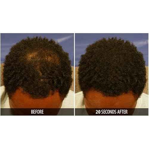 Dr. Yates MD Keratin Fiber Hair Enhancer (Dark Blonde)