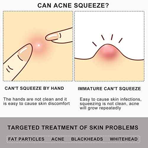 Pointed Blackhead Removal, 2-in-1 Acne Extractor Tool - Stainless Steel Whitehead Remover for Face/Nose