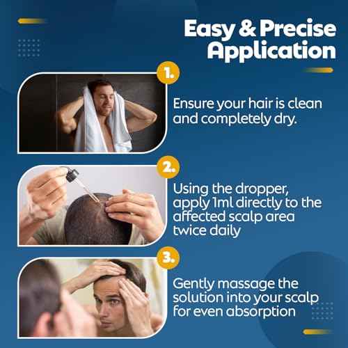 Minoxidil For Men 5% Topical Solution For Hair Regrowth Treatment 6 Month Supply 6 X 2 Fl Oz With A Braidz Comb