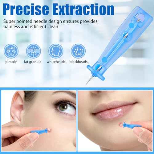 Sterile Needles for Pimples, 100Pcs Disposable Acne Lancet Effective Blemish and Blackhead Removal Tools for Clear Skin