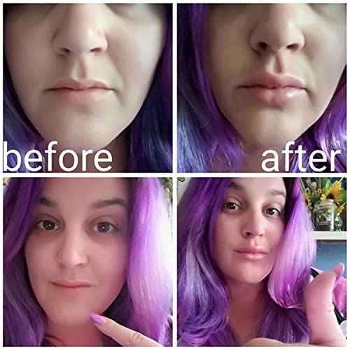 Lip Plumper Device | Soft Silicone Fish Shape Lips Enhancer,Fuller Thicker Mouth Fastly Lip Pumps Bigger Device for Women Female