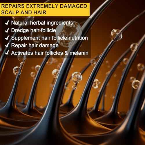 5% Minoxidil Hair Growth Serum, Topical Minoxidil for Men Beard Growth, Hair Regrowth for WomenTreatment for Scalp Hair Loss and Thinning, With Biotin