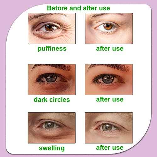 Hot and Cold Eye Pads, reusable eye patches - Soothing, Revitalizing, Puffiness, Refresh, Relieves Stress, Relax, Relieves Puffiness and Tension(2 watermelons + 2 cucumbers)