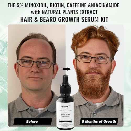 5% Minoxidil Hair and Beard Growth Serum - Natural Extracts, Biotin & Caffeine - Promotes Stronger, Thicker, Fuller Hair and Beard Growth - For Men and Women