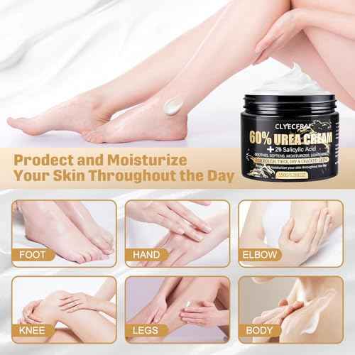 60% Urea Cream with 2% Salicylic Acid, Urea Cream 60 Percent for Feet & Hands- Maximum Strength Moisturizer for Rough, Dry, Thick & Cracked Skin, Callus Remover, Deep Hydration, 150g