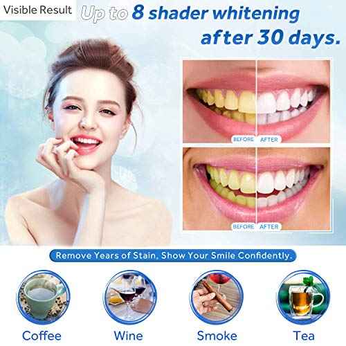 EZGO 10 Pack Teeth Whitening Gel Refills 22% Bleaching Gel, No Sensitive Teeth Whitener, Great for Sensitive Tooth Whitening, Carbamide Peroxide Teeth Whitening Gel, Mint Flavor (10X 3ML)
