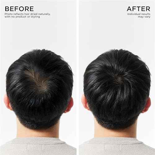 Dr. Groot Hair Thickening Shampoo, Korean Hair Care with Biotin, Rosemary Oil to Help Volumize Thinning, Damaged Hair, Hydrate Hair and Scalp, Biotin Shampoo, Scalp Revitalizing Solution