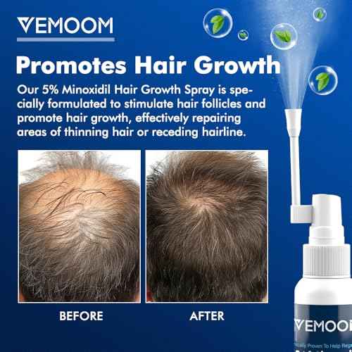 5% Minoxidil Hair Growth Spray for Women and Men, Effective Anti-Hair Loss Treatment for Regrowth, Extra Strength Scalp Solution, Thicker, Stronger and Longer Hair - 60ml*2