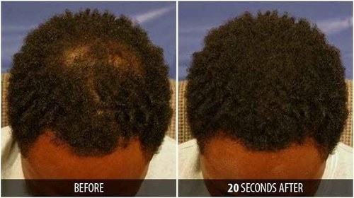 Dr. Yates MD Keratin Fiber Hair Enhancer (Black)
