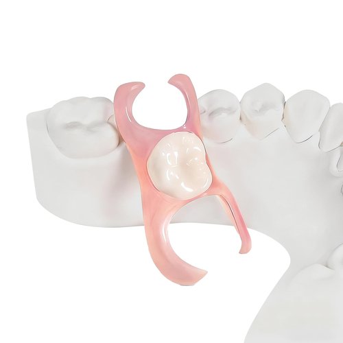 Partial Dentures - Custom Removable Personalized Tooth Replacement Set for Missing Teeth & Gap (1 Tooth)