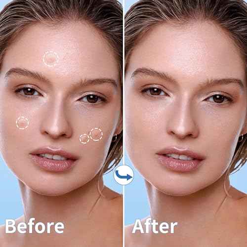 Pimple Patches for Face, 4 Size 300 Counts Acne Patches, Hydrocolloid Patches for Covering Zits and Blemishes, Spot Stickers with Salicylic Acid, Tea Tree Oil & Calendula Oil