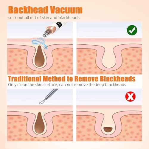 2025 Pore Vacuum, USB Rechargeable Blackhead Remover Vacuum,3 Levels Adjustable Pore Vacuum Blackhead Remover, with 5 Suction Power,6 Probes,Face Vacuum Pore Cleanser for Women & Men-White