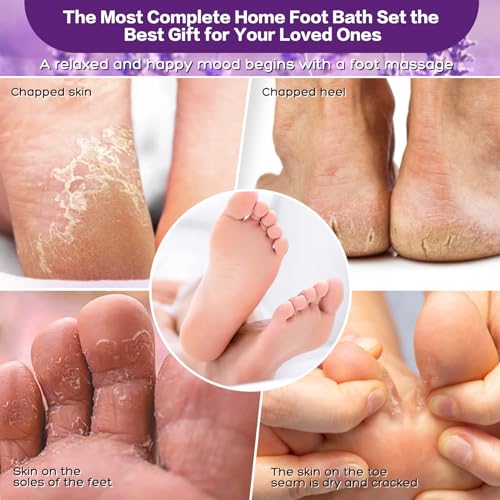 foot salt set Foot Soak with Epsom Salt - For Toenail Repair, Athletes Foot, Softens Calluses, Soothes Sore & Tired Feet¡¦