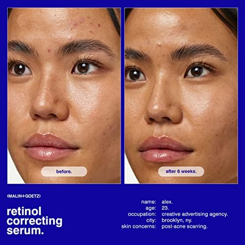 MALIN+GOETZ Retinol Correcting Serum | Multi-Vitamin Retinol Serum with Vitamins A, C, E + Superoxide Dismutase | Smooths Texture, Brightens, Firms + Reduces Fine Lines | Vegan + Cruelty-Free(1 Fl Oz)