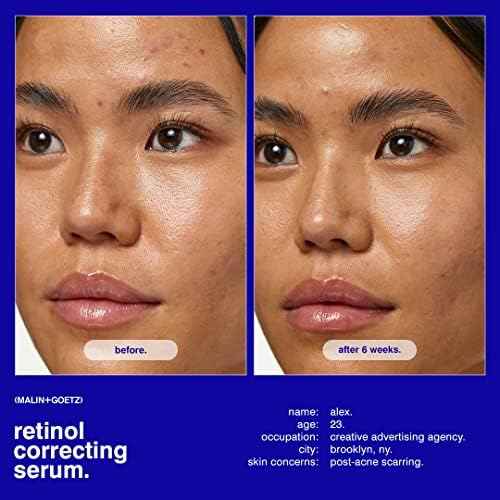 MALIN+GOETZ Retinol Correcting Serum | Multi-Vitamin Retinol Serum with Vitamins A, C, E + Superoxide Dismutase | Smooths Texture, Brightens, Firms + Reduces Fine Lines | Vegan + Cruelty-Free(1 Fl Oz)