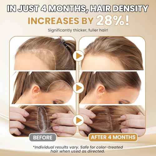 5% Minoxidil for Women Hair Growth Serum Topical Minoxidil Hair Regrowth Thicker Prevent Hair Loss for Thickening Longer Fuller Healthier Hair 3 Bottles of 2oz