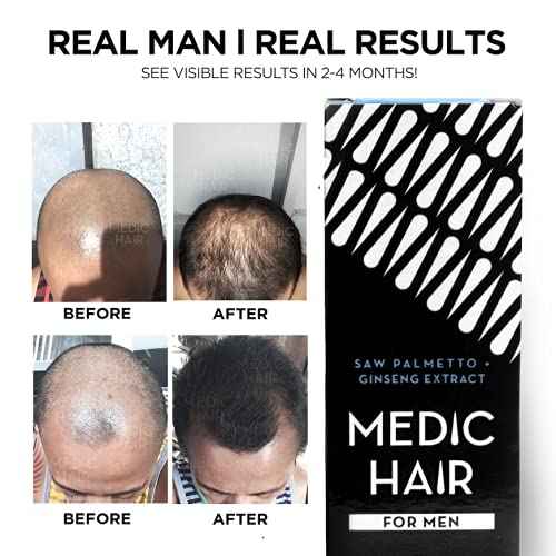 MEDIC HAIR FOR MEN 90ml, 3.04 fl oz, Contains Saw Palmetto and Ginseng Extract, DHT Blocking, Natural, Healthy Hair Growth