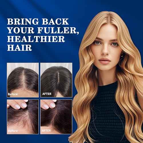 5% Minoxidil Hair Growth for Men and Women Spray Kit : Regrowth Topical Solution for Beard - Extra Strength Treatment Serum with Biotin for Hair loss & Thinning - 2PCS