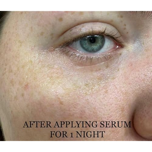 Shwally Methylene Blue Serums (Clear Spot Treatment, 1oz)
