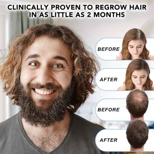 Minoxidil for Men-5% Extra Strength Hair Regrowth for Men Treatment-5% Topical Solution-Dropper Applicator Included -Minoxidil for Women-Stop Thinning & Hair Loss (1pcs