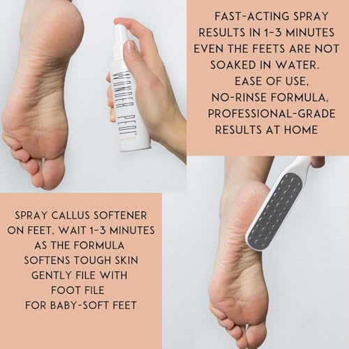 Callus Remover - Three Minutes Quick Fix- Foot File Rasp - Instant Foot Exfoliating Softener Peel Spray, Heels Callus Scrubber File - Home Spa Pedicure Treatment. Wonder Pedi
