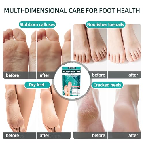 EXTRA STRENGTH Ocean Tea Tree Oil Foot Soak Salt ? Dead Sea & Epsom Salt with Natural Essential Oils ? Foot Bath for Odor, Callus Softening & Toenail Care ? Relax Tired Feet, Home Spa Use 16oz
