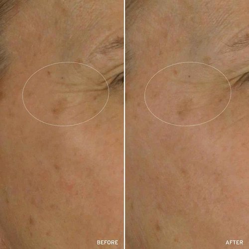 Aramore NAD+ Cell Energizing Skin Care Treatment with Proprietary NAD+ Precursor Complex, Clinically Proven to Target 12 Signs of Aging - 50ml