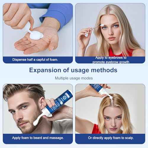 5% Topical Minoxidil Foam, Minoxidil for Men and Women, Infused with Biotin, Hair Growth Treatment, Supports Thicker and Fuller Hair & Beard (Minoxidil Foam, 8.44oz, 4 Month Supply)