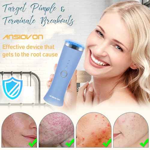 Blue Light Therapy Device for Acne Spot Treatment - LED Acne Blue Light Therapy Wand for Face