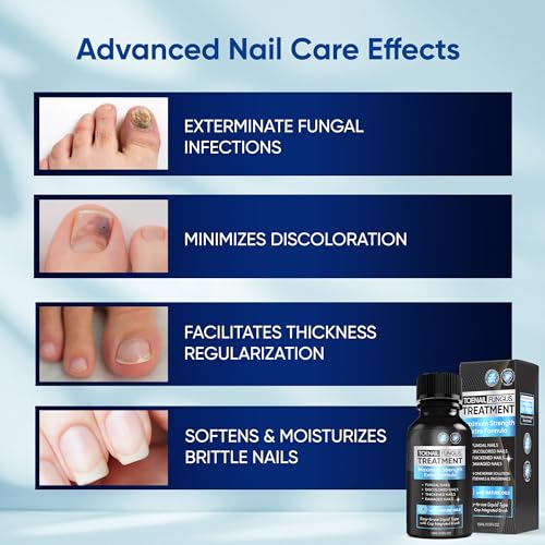 Fungus Treatment for Toenails, Toe Nail Fungus Treatment Extra Strength, Toenail Fungus Treatment, Fast Acting - 2 Packs, Black