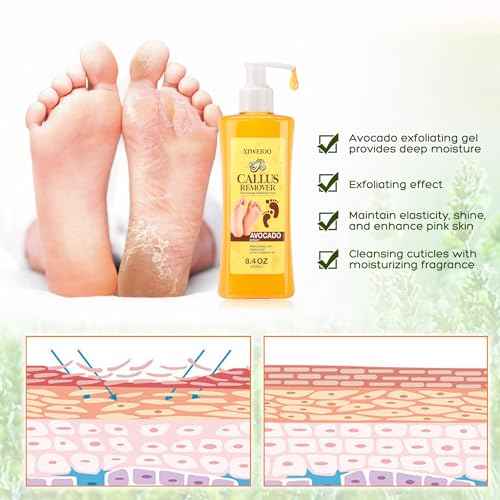 Foot Callus Remover Gel Kit Heel Exfoliator Dead Skin Remover Pedicure Foot Spa Products Set Home Pedicure Foot Care Spa Supplies for Rough, Dry, Cracked Skin Cracked Heel, Professional