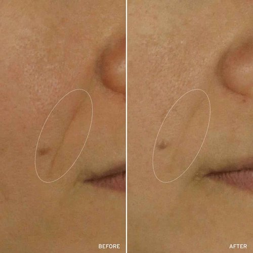 Aramore NAD+ Cell Energizing Skin Care Treatment with Proprietary NAD+ Precursor Complex, Clinically Proven to Target 12 Signs of Aging - 50ml