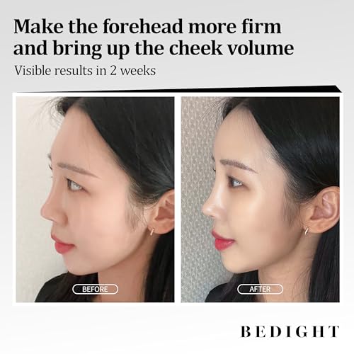 Facemoon Cream - Firming & Volumizing Cream for Forehead & Cheeks | Anti-Aging Wrinkle Cream | Volufiline Korean Wrinkle Peptide for Anti-Sagging | Korean Pocket Ball(50ml / 1.7 fl.oz)