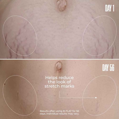 MAËLYS Cosmetics B-FLAT Belly Firming Cream - Stretch Mark Tightening Belly Cream - 3 Pack