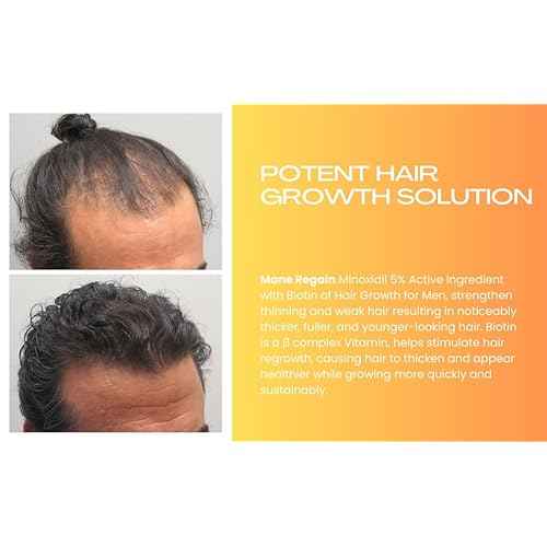 Minoxidil Topical Solution USP 5%, Extra Strength Hair Regrowth Treatment for Men, 2 Month Supply, Unscented, 4 Fl Oz (2 Pack)