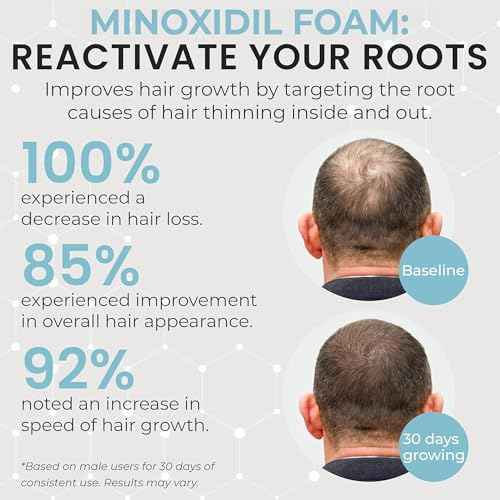 Remixidil Men¡¯s 5% Minoxidil Foam | Hair Regrowth Treatment for Men | Clinically Proven Formula for Hair Loss and Hair Growth | No Scalp Irritation | 3-Month Supply