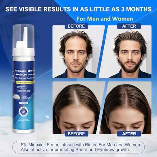 5% Topical Minoxidil Foam, Minoxidil for Men and Women, Infused with Biotin, Hair Growth Treatment, Supports Thicker and Fuller Hair & Beard (Minoxidil Foam, 12.66oz, 6 Month Supply)