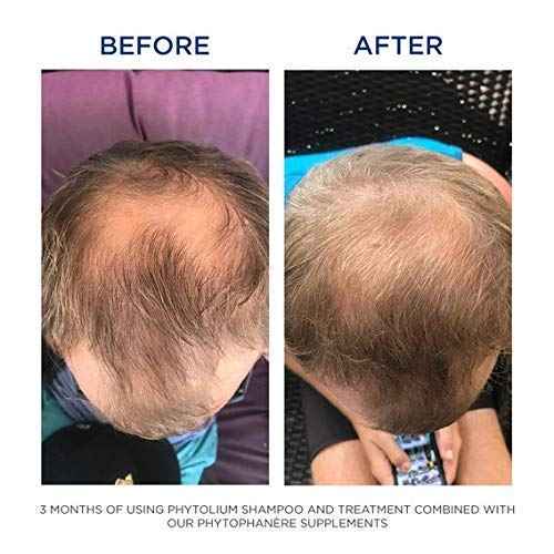 PHYTO Phytophanère 100% Natural Hair Loss Thinning Dietary Supplement, 4-Month Supply