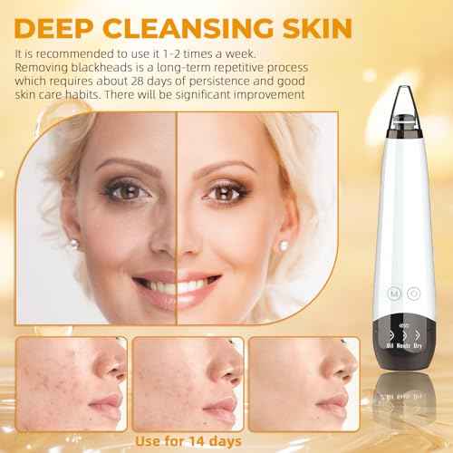 2025 Pore Vacuum Kit, USB Rechargeable Blackhead Remover Vacuum Kit,3 Levels Adjustable Pore Vacuum Blackhead Remover, with 6 Suction Power Probe,4 Golden Needle face Vacuum Pore Cleanser Kit-White